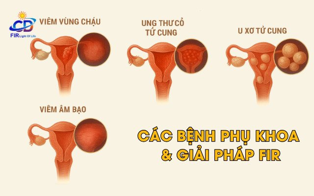 Các Bệnh Phụ Khoa – Nguyên Nhân, Triệu Chứng & Giải Pháp Hỗ Trợ Bằng FIR
