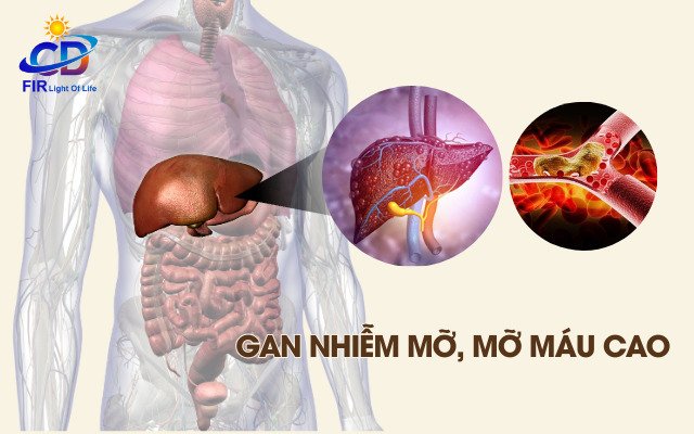 Gan Nhiễm Mỡ – Nguyên Nhân, Triệu Chứng & Giải Pháp Hỗ Trợ Bằng Công Nghệ Nano Bán Dẫn FIR