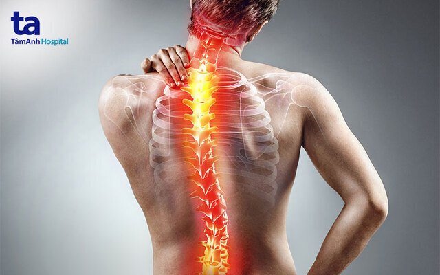 Đau Lưng – Nguyên Nhân, Triệu Chứng & Giải Pháp Bằng Công Nghệ Nano Bán Dẫn FIR
