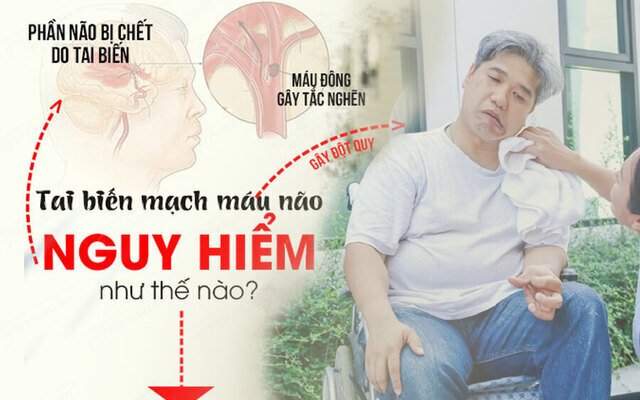 Tai Biến – Phục Hồi & Giải Pháp Hỗ Trợ Bằng Công Nghệ Nano Bán Dẫn FIR
