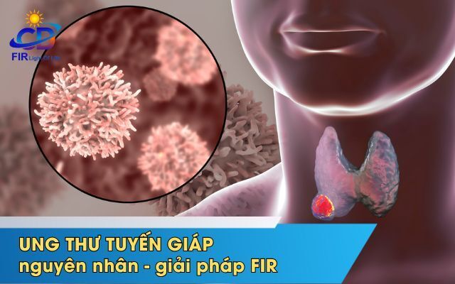 UNG THƯ TUYẾN GIÁP – KHI CƠ THỂ GỬI ĐI TÍN HIỆU CẦU CỨU & ÁNH SÁNG HỒNG NGOẠI XA (FIR) HỖ TRỢ PHỤC HỒI TỪ BÊN TRONG