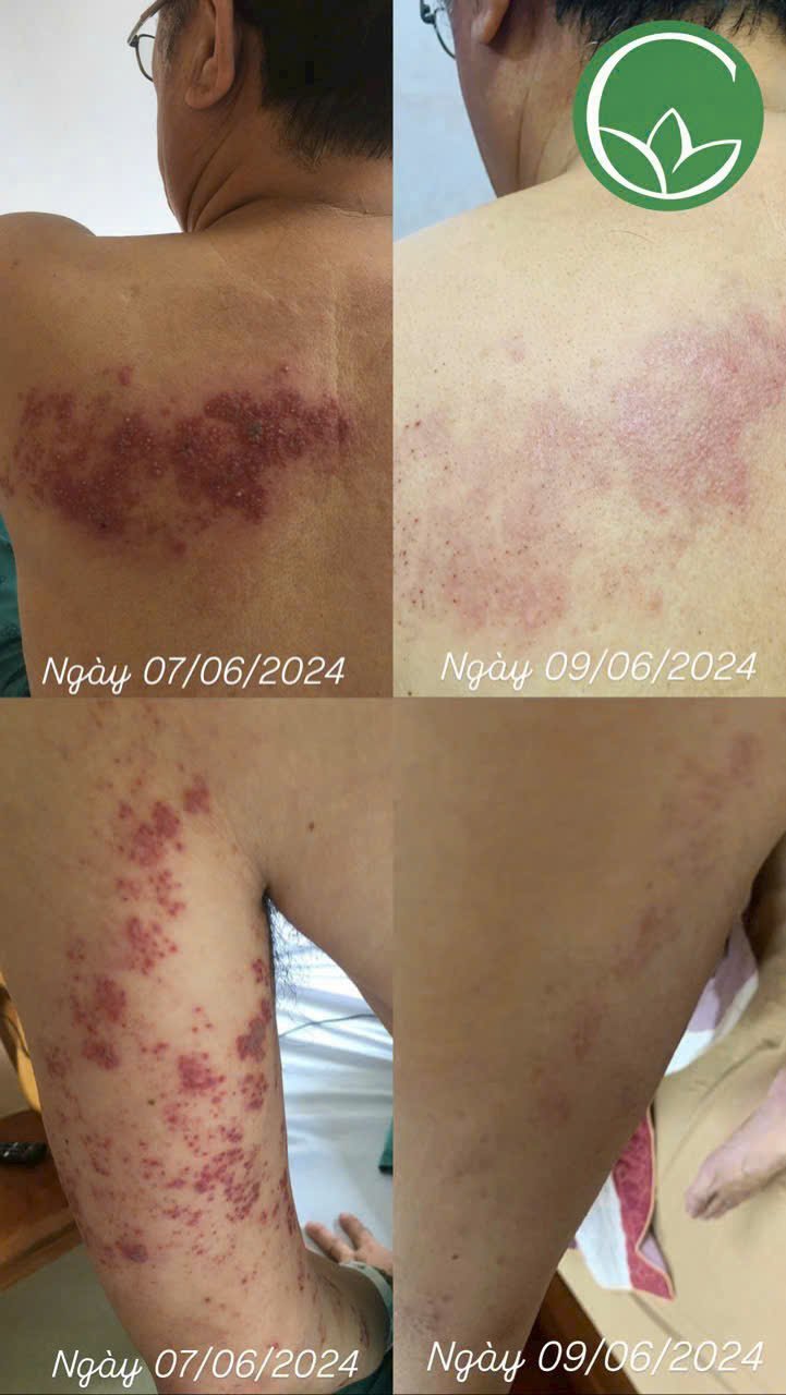 Y học năng lượng, chăm sóc sức khỏe công nghệ cao