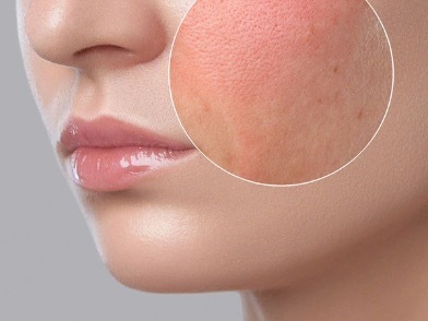 dermtalk-cham-soc-da-kho-1