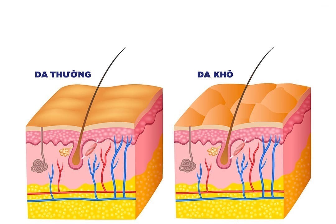 dermtalk-cham-soc-da-kho-2