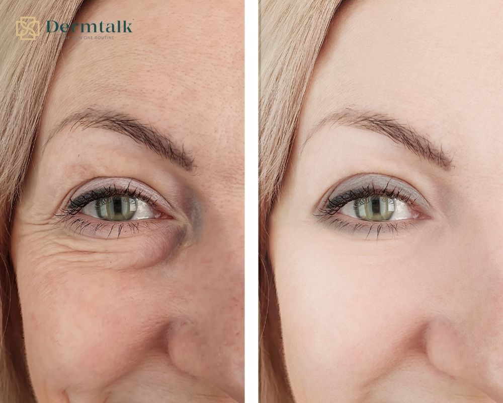 vi-sao-peptide-lai-la-than-duoc-trong-serum-xoa-nep-nhan