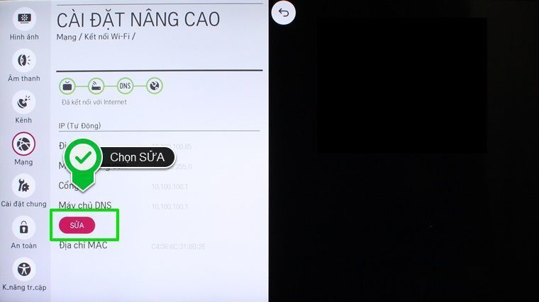 cách cài đặt ip và dns mạng cho smart tivi lg hệ điều hành webos